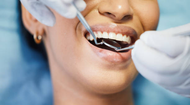 Best Emergency Dental Care for Sports Injuries in Sheldon, IL